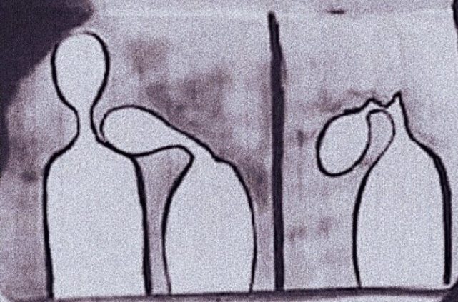 Dependência/incompetência – Terapia de Esquemas